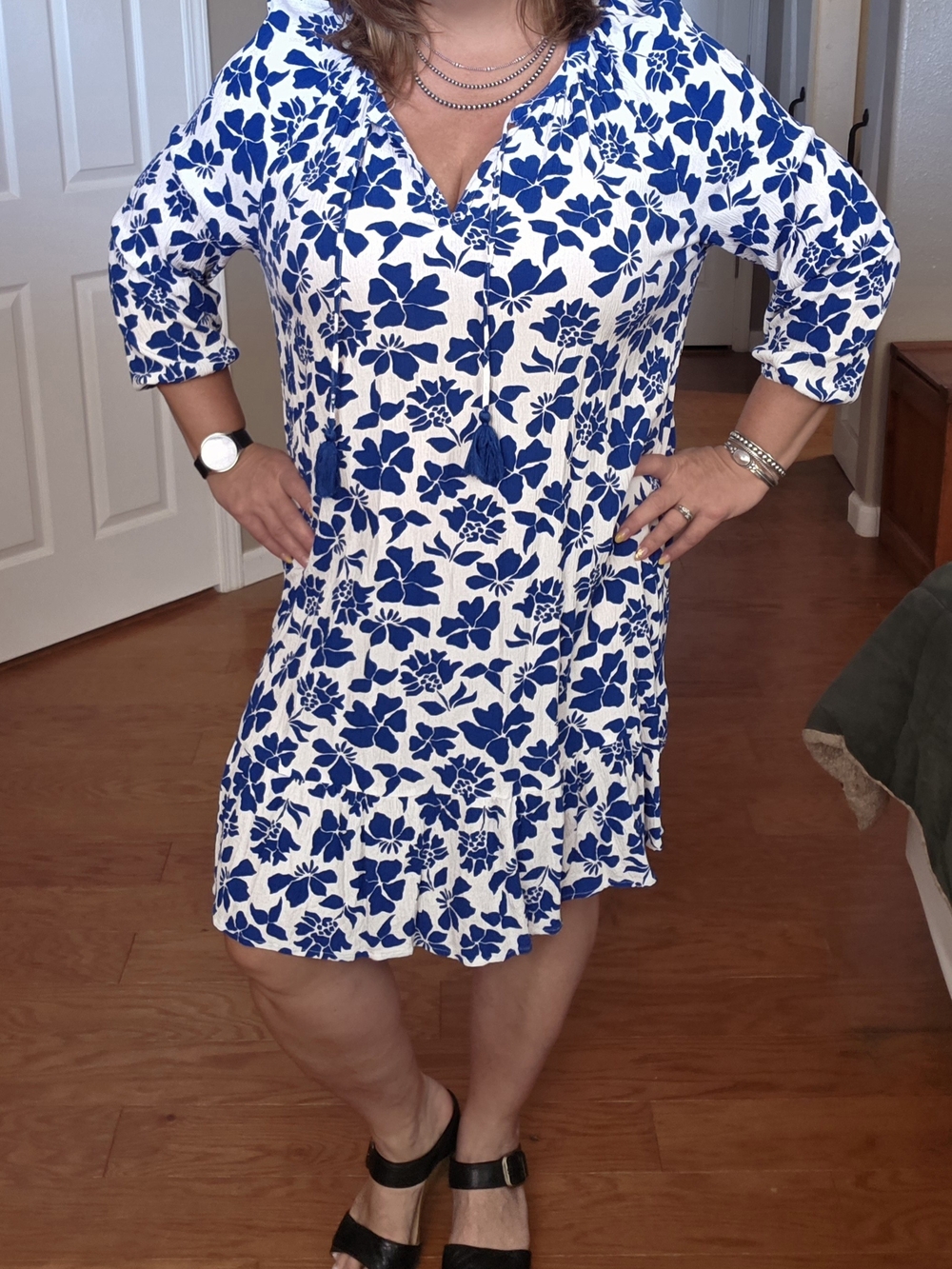 Blue and White Floral Tunic Dress